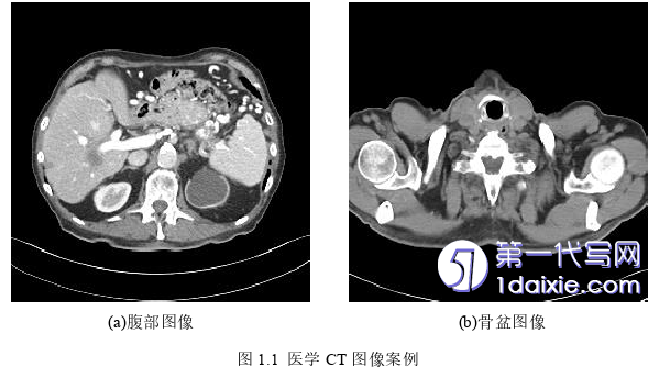 医学论文怎么写